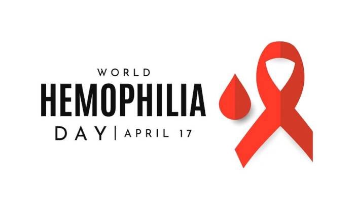 April 17 : આજે છે વિશ્વ હિમોફિલિયા દિવસ, તો જાણીએ આ દિવસના મહત્વ વિષે