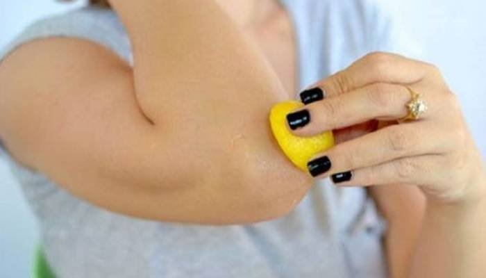 કોણીની કાળાશ દૂર કરવા અપનાવો 2 સરળ ઘરેલુ ઉપાય, અજમાવો આ ખાસ ટિપ્સ